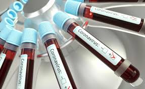 Coronavirus, aumentano i positivi in provincia di Trapani. Sono 312. A Marsala 38